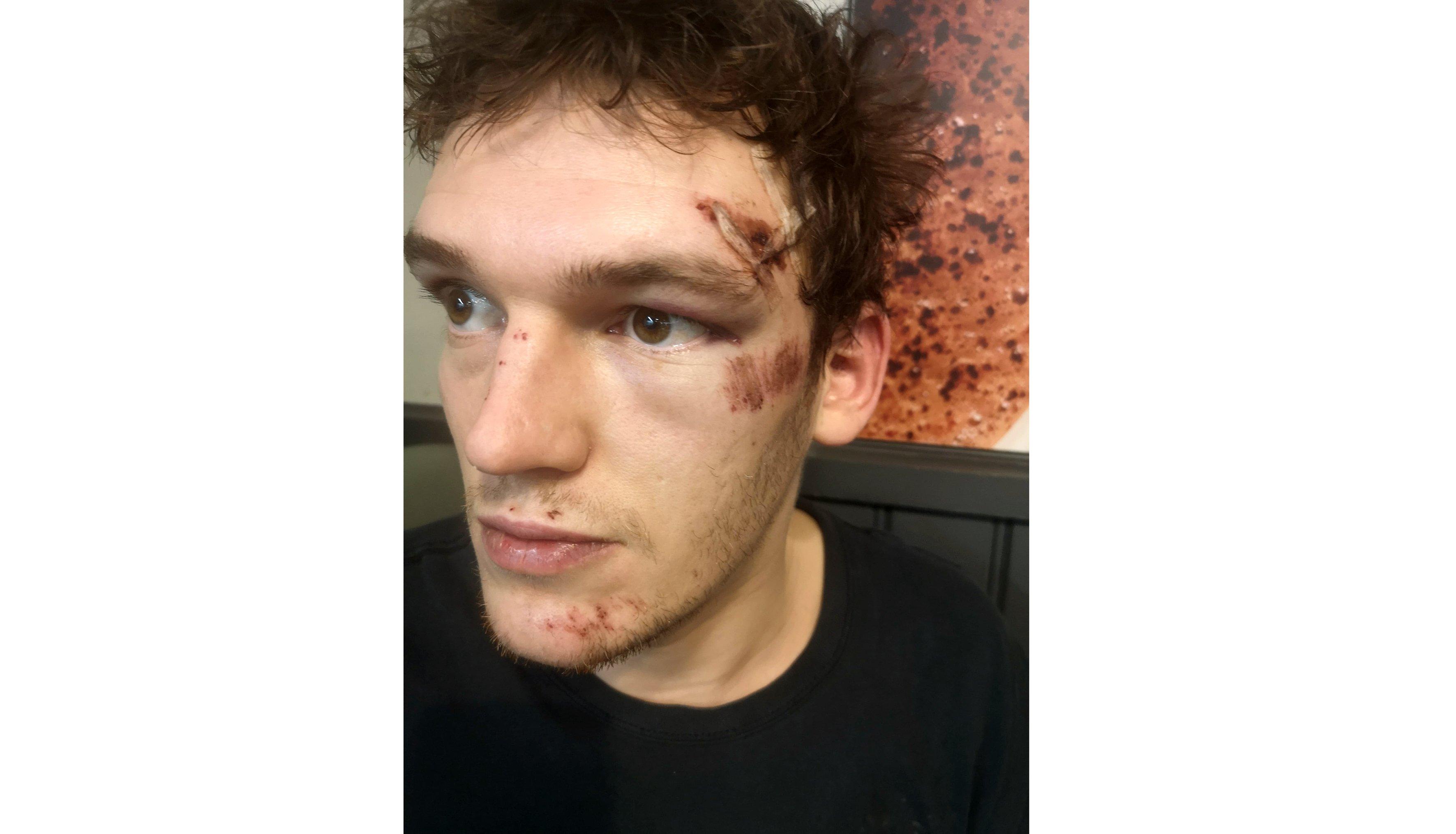 Murray Cross, 28, was found unconscious on the ground in Elm Grove, Hayling Island, and was taken to QA Hospital to be treated for his injuries