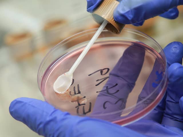 A person in the UK has died in an E.coli outbreak. (Photo: Sean Gallup/Getty Images)