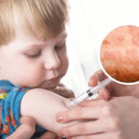 A national incident has been declared following a rise in Measles cases.
