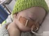 "Warrior” Portsmouth baby born prematurely fights for life days before first birthday