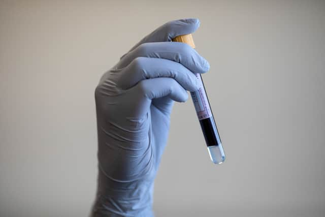 Contaminated blood scandal.  (Credit: Simon Dawson/PA Wire)