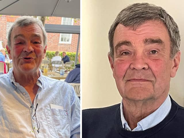 Jim Dick, 71, suffered from droopy eyelids for many years due to a condition he inherited from birth, and which worsened with age.
