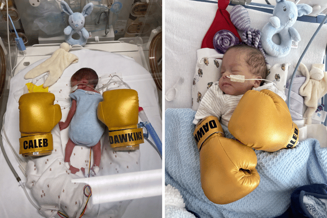 Caleb had to spend much of his time at QA Hospital in the Neonatal Intensive Care Unit.