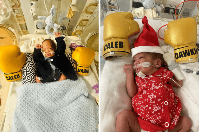 Caleb had to be put on oxygen while in the Neonatal Intensive Care Unit (NICU) at QA Hospital.