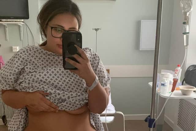 Sofia Alessia before weight loss surgery.