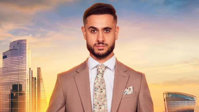 Hair transplant consultant from Middlesbrough