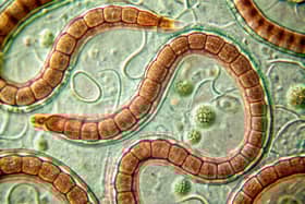 The tapeworm diet dates back to the Victorian era and can have dangerous consequences for your health.