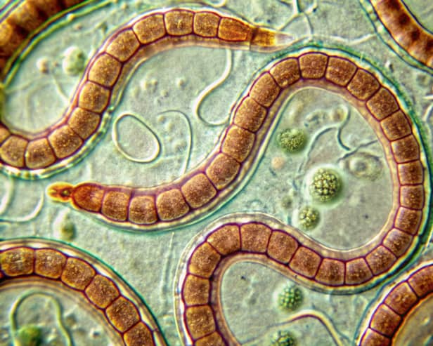 The tapeworm diet dates back to the Victorian era and can have dangerous consequences for your health.
