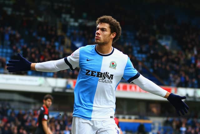 Head of Football Rudy Gestede is a former Blackburn Rovers player