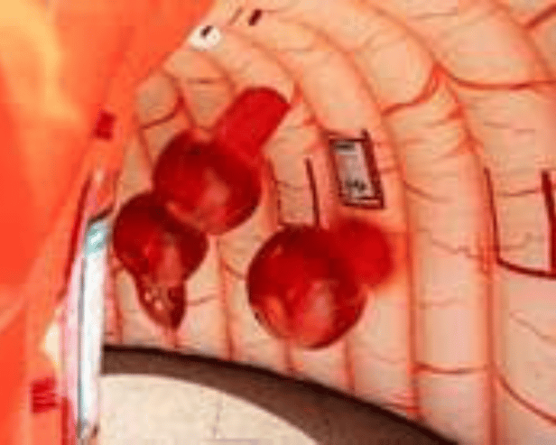 A giant inflatable bowel is going to be set up in Portsmouth to raise awareness for bowel cancer.