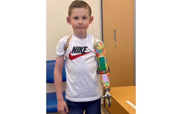 Tobi loves showing off his new bespoke prosthetic arm which has two pieces of real Lego in it.