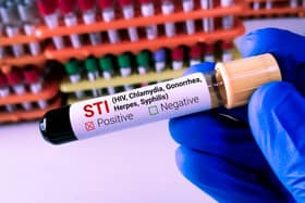 STIs in Portsmouth have fallen by 18 per cent from 2023 to 2024.