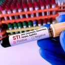 STIs in Portsmouth have fallen by 18 per cent from 2023 to 2024.