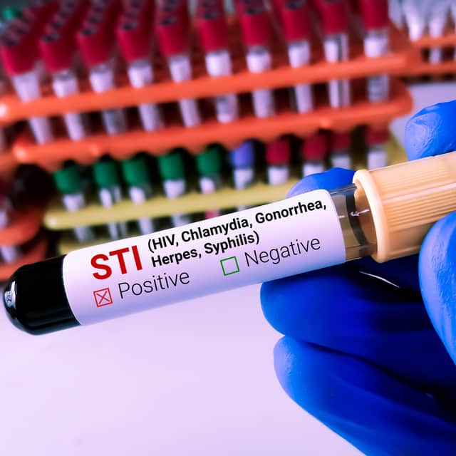 STIs in Portsmouth have fallen by 18 per cent from 2023 to 2024.