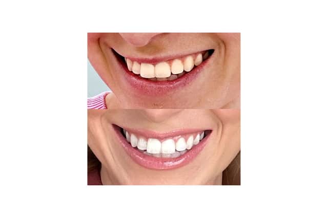 MySweetSmile: The UK’s best-selling teeth whitening brand trusted by over one million customers