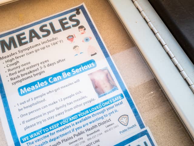 Measles is a highly contagious viral infection.