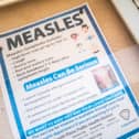 Measles is a highly contagious viral infection.