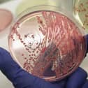 Cases of a deadly strain of E.coli rose by 26% last year.