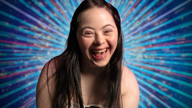 Ellie Goldstein has been announced for Strictly Come Dancing