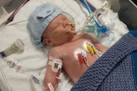 Shortly after George was born in QA on November 20, it was discovered he had a rare condition called transposition of the great arteries.