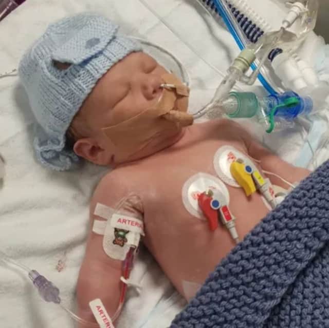 Shortly after George was born in QA on November 20, it was discovered he had a rare condition called transposition of the great arteries.
