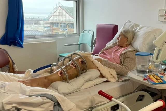 Liz Pullen has been in hospital for the past six weeks after being knocked off her moped at the start of the year in a hit and run.