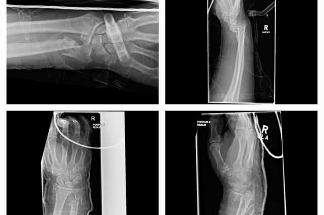 Peter Wright’s X-Rays