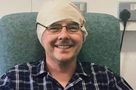 Radiotherapy after surgery ‘reduces risk of recurrence of certain brain cancers’ 


Pictured: Andy Tudor, from Denmead 