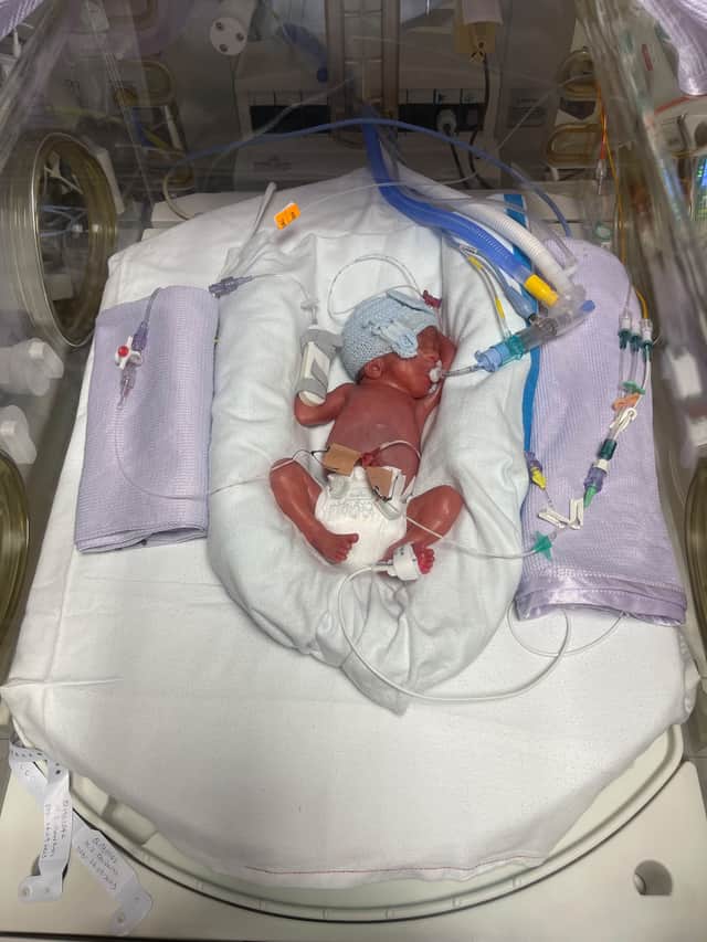 Caleb was born three months premature