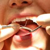 NHS England is looking for two new dental practices to open in Portsmouth. Martin Rickett/PA Wire