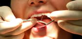 NHS England is looking for two new dental practices to open in Portsmouth. Martin Rickett/PA Wire