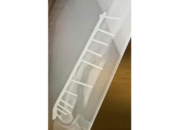 An X-ray showing the plate and pins put into Dan Fallon's arm in January 2022.