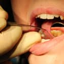 A fresh plea has been made for a new dental surgery to be opened in Cosham to help ease the city's incredible frustrating problems with finding appointments for NHS dentists.: Rui Vieira/PA Wire