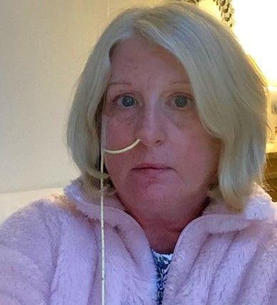 During treatment on her throat, Mandy was fed through a nasogastric tube but has since recovered and can eat, drink, breathe and talk normally.