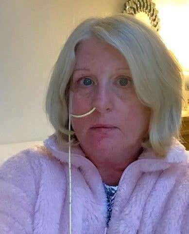 During treatment on her throat, Mandy was fed through a nasogastric tube but has since recovered and can eat, drink, breathe and talk normally.