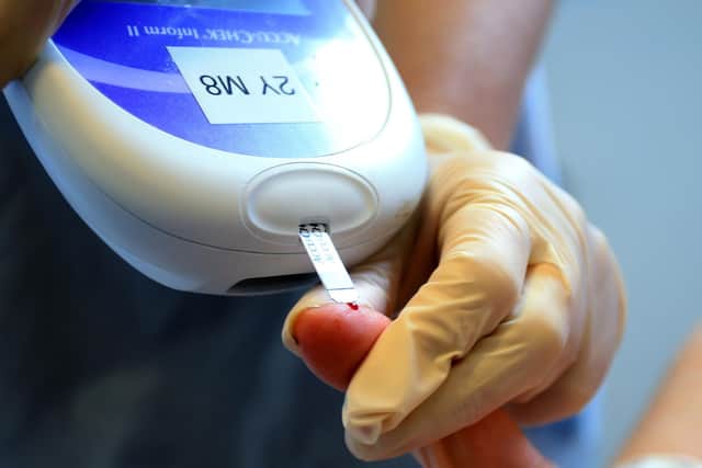 Researchers at the University of Portsmouth are seeking volunteers to try out the new system which will see if breathing lower amounts of oxygen (hypoxia) during sleep could lead to weight loss. Pic Peter Byrne/PA Wire