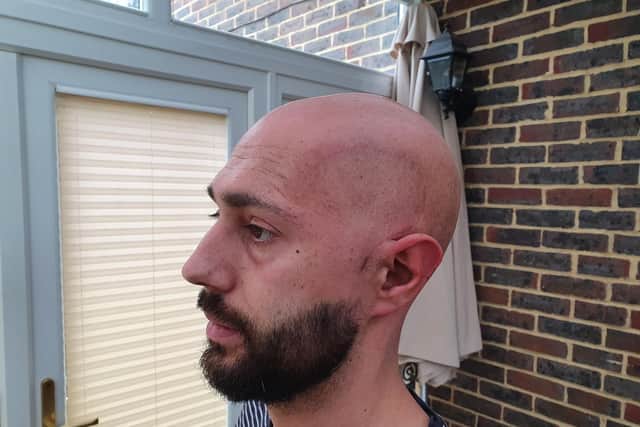 Dan Braiden, 31, of Cosham, near Portsmouth, was diagnosed with a brain tumour a year after successful treatment for testicular cancer
Picture: Brain Tumour Research