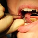 A dentist at work.