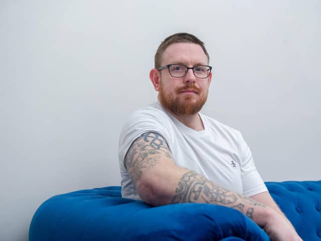 Dan Fallon broke his arm but had to wait 16 days for an operation as it wasn't deemed critical by the NHS. It's healed wonky as a result and he had a botched pin operation which means he may never regain the use of his right arm

Pictured: Dan Fallon at his home in North End, Portsmouth on Tuesday 8th February 2022

Picture: Habibur Rahman