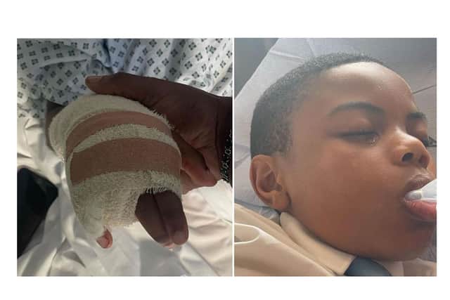 Raheem Bailey, 11, lost a finger after an attack by a group of children at school, his mum Shantal Bailey has claimed. Photo: @muslima_vegan/Instagram