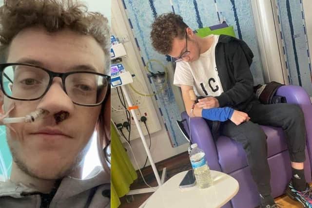 Jack Beames, 21, is battling his fourth round of cancer and is trying to raise awareness for Ewing's Sarcoma which is a rare type of bone cancer. 
He was first diagnosed in 2015 after professionals found a tumour in his back.