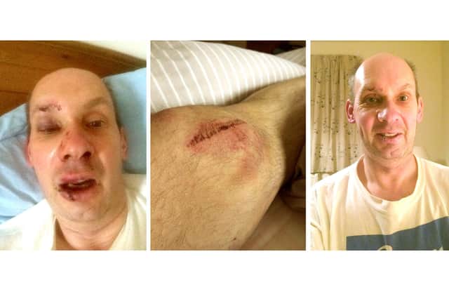 QA Hospital surgeon Professor Peter Brennan