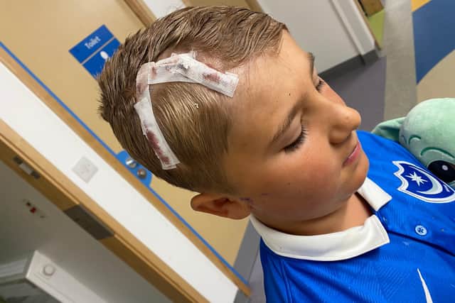 Reggie Mears, eight, pictured after his operation to fit a metal plate in his skull.