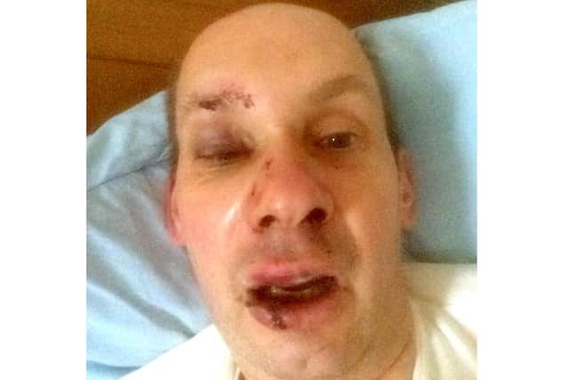 Top QA Hospital surgeon Professor Peter Brennan fell 18ft from a ladder while cleaning the gutters at his home near Southampton. Picture: Prof Peter Brennan.
