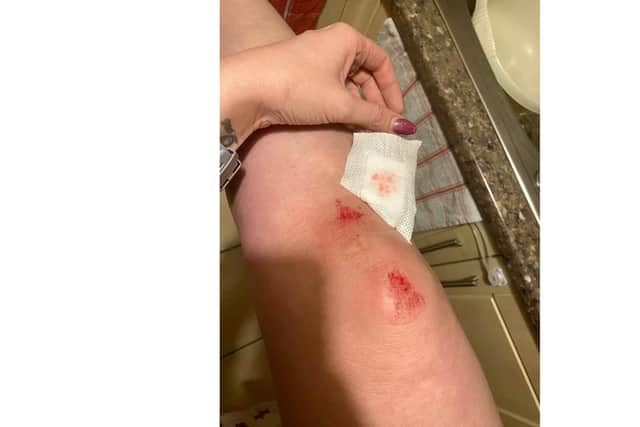 Images of Lucie Wakely, 30, after she was assaulted by her former partner Zac Slaven on Christmas Day 2019 at her home. Picture: Lucie Wakely