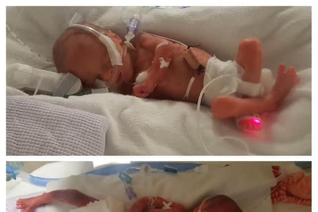 Ronny and Bella in hospital