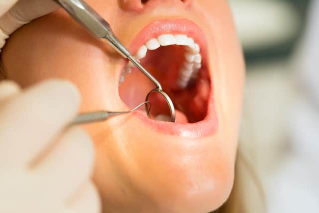 Dentists are reopening