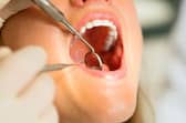 Dentists are reopening