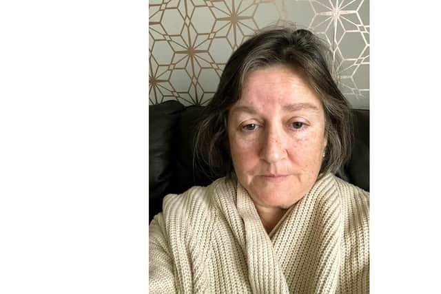 Jackie Britton, aged 59, who lives in Fareham, had a blood transfusion in 1983 following the birth of her first child - and discovered almost 30 years later that she had been given infected blood.