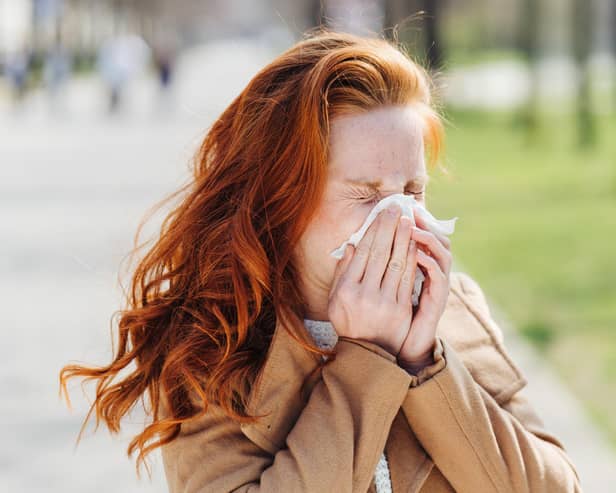 Hay fever is affecting people this year due to a high pollen level (Photo: Adobe Stock)